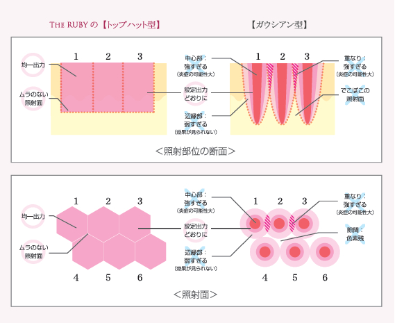 The Ruby nano_Qの特徴